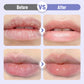 🎉 Up to 50% OFF! Moisturizing Lip Balm — Limited-Time Offer ⏰🔥